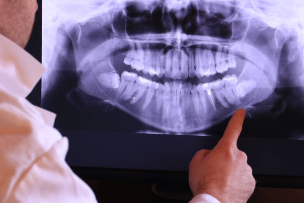 Best Broken Tooth Emergency  in Hanover, MN