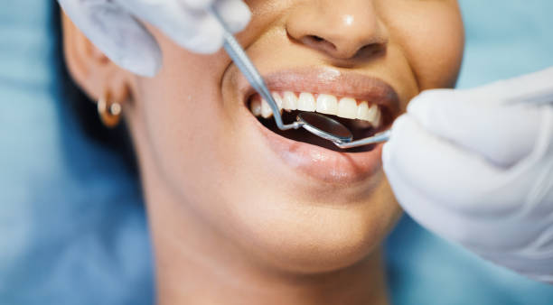 Best Urgent Tooth Repair  in Hanover, MN